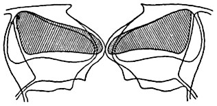 Рис. 96.    Схематизированный     оптический разрез устьица зимовника (Heiieborus sp.)   в закрытом   и   открытом состоянии.